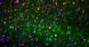 Fluorescence microscopy showing neurons labelled with spatial transcriptomics.