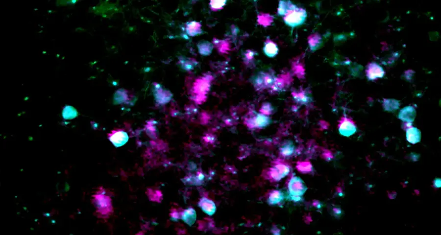 Registered microscopy field with cyan and magenta neuronal signals overlaid, showing matched cells.